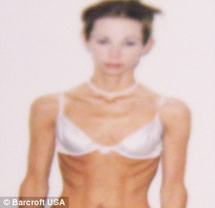 Laura's eating disorder worsened when she went to college and developed bulimia